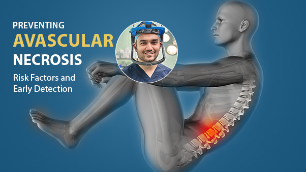 Preventing Avascular Necrosis: Risk Factors and Early Detection